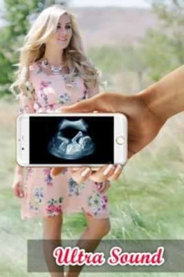 Play Ultrasound Scanner Prank 