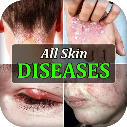 Play All Skin Diseases  Treatment APK