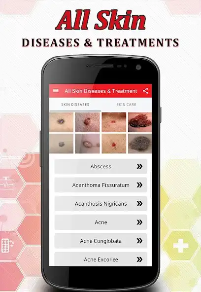 Play All Skin Diseases  Treatment as an online game All Skin Diseases  Treatment with UptoPlay