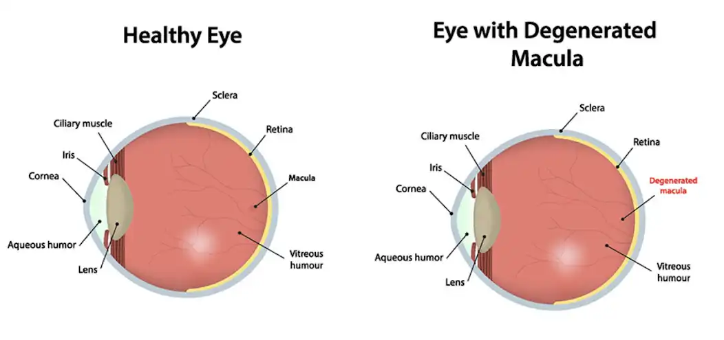 Play Amsler Grid Macular Degeneration Test  and enjoy Amsler Grid Macular Degeneration Test with UptoPlay