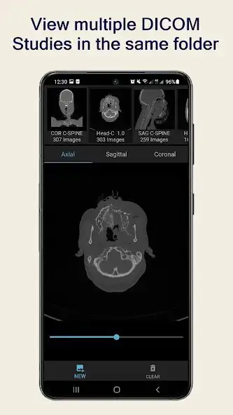 Play Anatomy Viewer: CT/MRI Images as an online game Anatomy Viewer: CT/MRI Images with UptoPlay