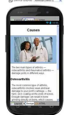 Play Arthritis Disease  Symptoms