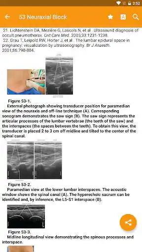 Play Atlas of Ultrasound Anesthesia as an online game Atlas of Ultrasound Anesthesia with UptoPlay