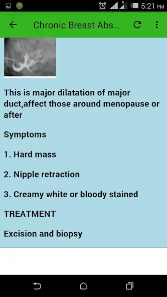 Play Breast mastitis and treatment as an online game Breast mastitis and treatment with UptoPlay