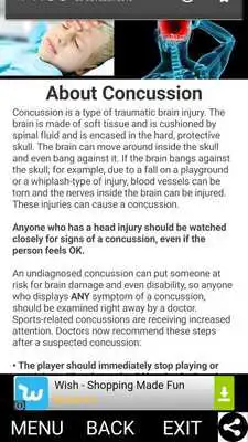 Play Concussion Injuries