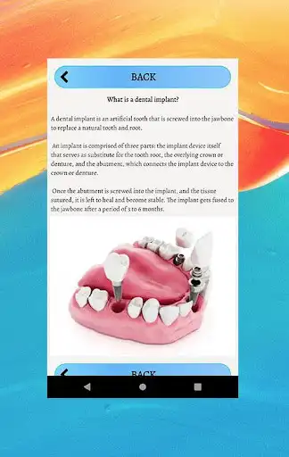 Play Dental Implants Guide as an online game Dental Implants Guide with UptoPlay