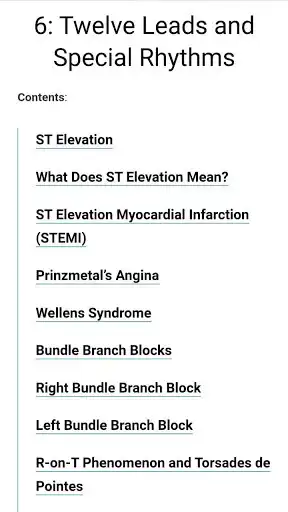 Play ECG: Basics and Interpretation as an online game ECG: Basics and Interpretation with UptoPlay