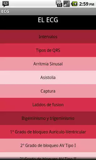 Play Electrocardiograma ECG Tipos