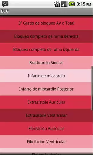 Play Electrocardiograma ECG Tipos