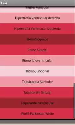 Play Electrocardiograma ECG Tipos