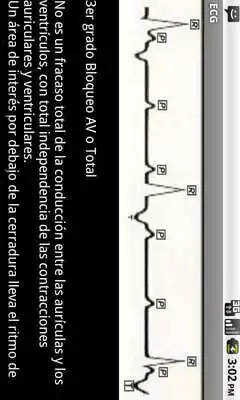 Play Electrocardiograma ECG Tipos