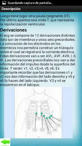 Play Electrocardiograma