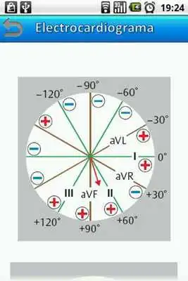 Play Electrocardiograma