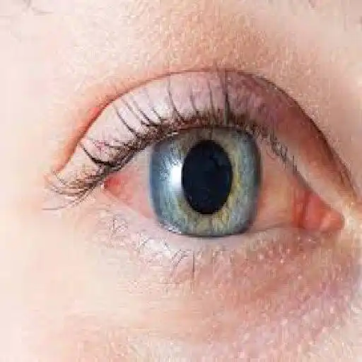 Play Eye Disease Classifier APK