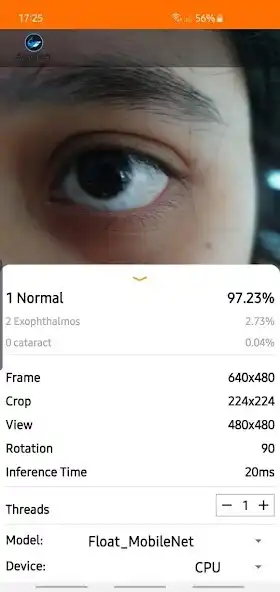 Play Eye Disease Classifier  and enjoy Eye Disease Classifier with UptoPlay