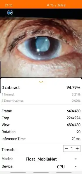 Play Eye Disease Classifier as an online game Eye Disease Classifier with UptoPlay