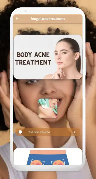 Play fungal acne treatment  and enjoy fungal acne treatment with UptoPlay