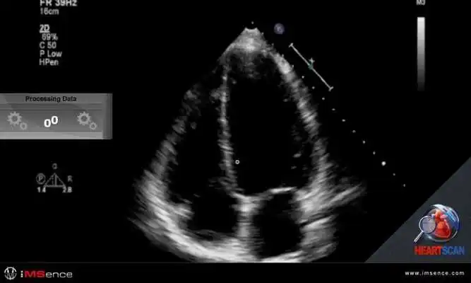 Play Heart Scan