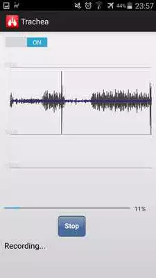 Play Lung Sound Recorder