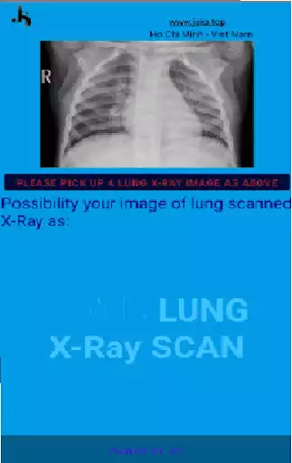 Play LungXrayScan  and enjoy LungXrayScan with UptoPlay