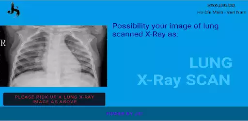 Play LungXrayScan as an online game LungXrayScan with UptoPlay