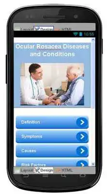 Play Ocular Rosacea Information