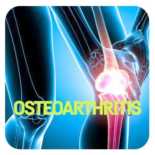 Free play online Osteoarthritis Disease APK