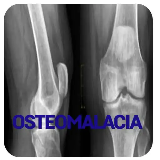 Run free android online Osteomalacia Disease APK