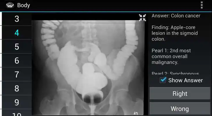 Play Radiology Flashcards: Free