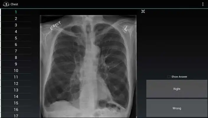 Play Radiology Flashcards: Free