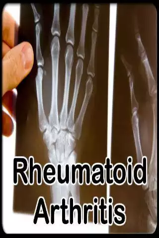 Play Rheumatoid Arthritis Treatment  and enjoy Rheumatoid Arthritis Treatment with UptoPlay