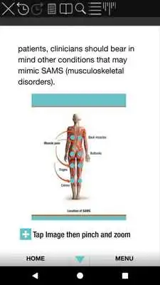 Play Statins and SAMS