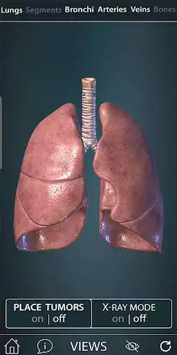 Play Surgical Anatomy of the Lung