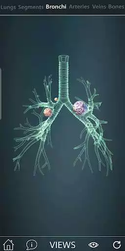 Play Surgical Anatomy of the Lung